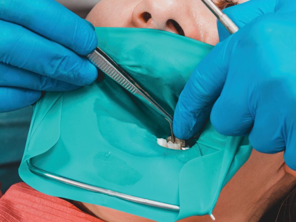 Dentists Master Dental Dam Placement Techniques?