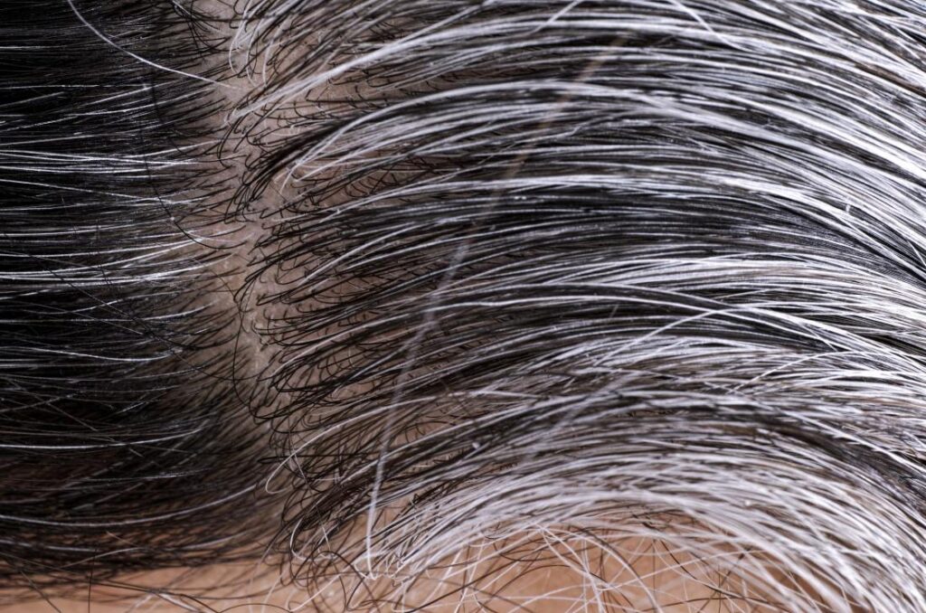 causes of white hair and easy ways to prevent it naturally