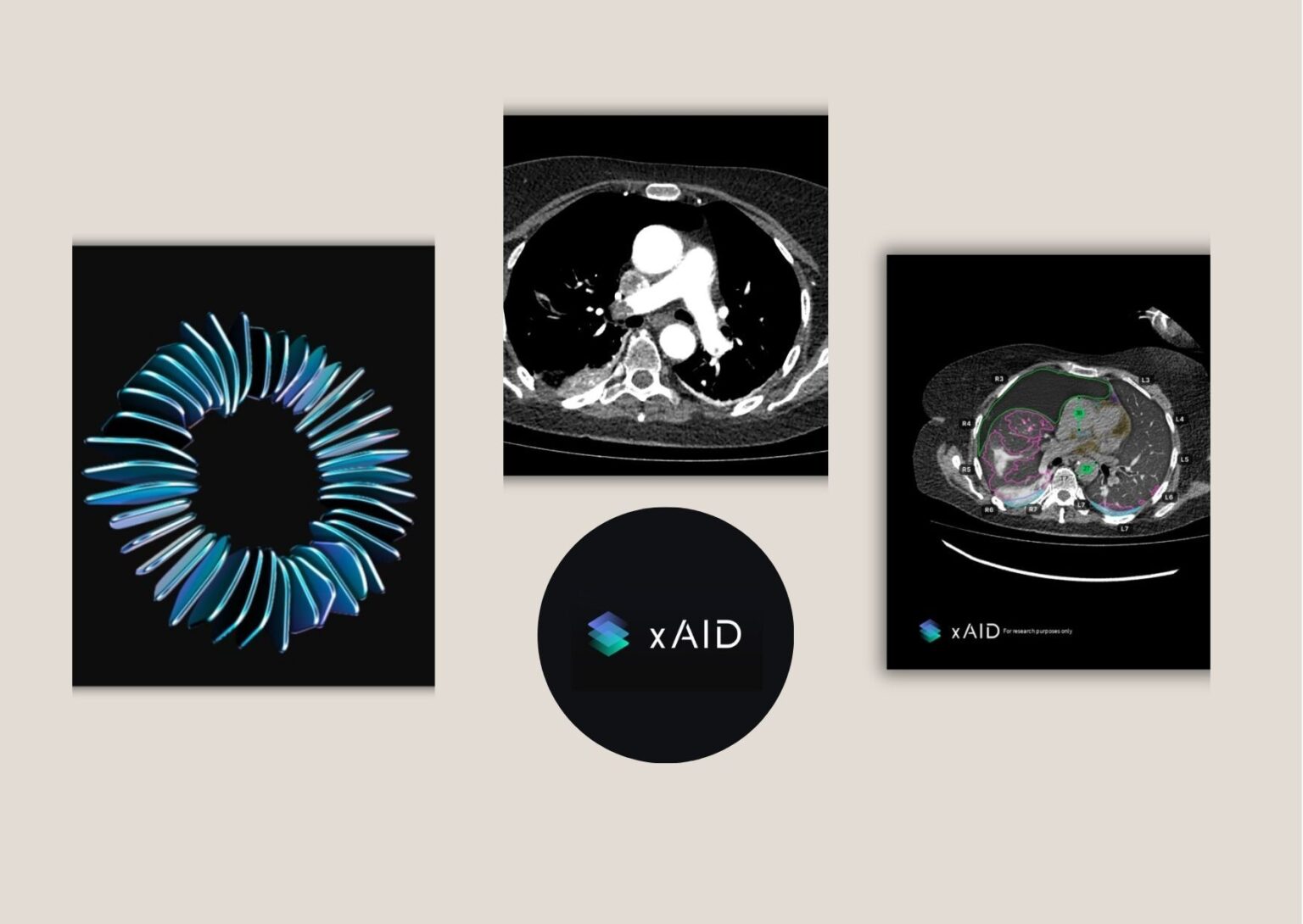 Expert Checklist for Choosing AI Radiology Vendors